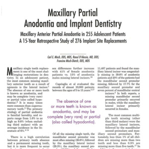 maxillary-copertina